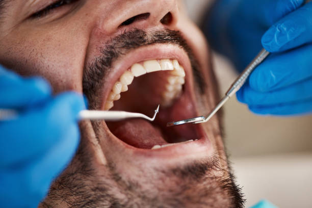 Best Emergency Dental Care for Broken or Chipped Teeth in Ottawa Hills, OH